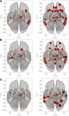 Right-Lateralized Enhancement of the Auditory Cortical Network During Imagined Music Performance